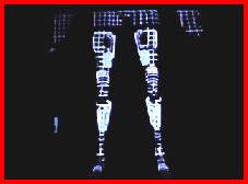 jambes bioniques